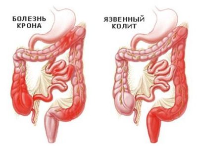 Иллюстрация 3