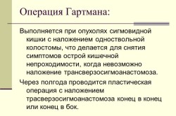 Операция Гартмана