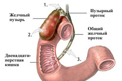 Этапы удаления желчного пузыря