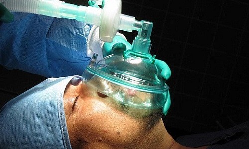 Необходимость эндотрахеального наркоза Необходимость эндотрахеального наркоза