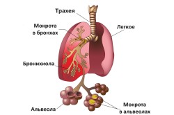 Пневмония - осложнение после операции на легких