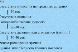 Признаки агонального состояния