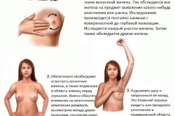 Самостоятельное обследование молочной железы