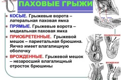 Виды паховых грыж