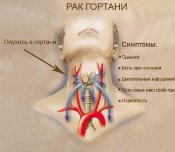 Иллюстрация 4
