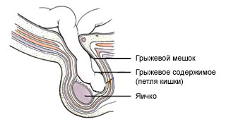 Врожденная патология у малышей