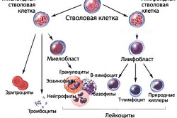 Образование хронического лимфоцитарного лейкоза