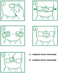 Как правильно накладывать пластырь